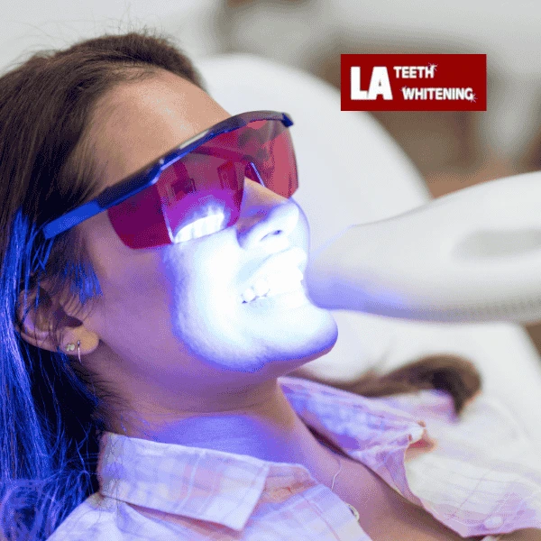 Contact LA Teeth Whitening Today! Book your appointment!Contact LA Teeth Whitening Today! Book your appointment! Leighton Buzzard