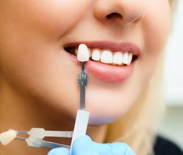 How Will I Know When It&rsquo;s Safe to Repeat Whitening Leighton Buzzard