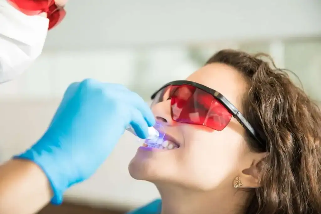 Laser Teeth Whitening FAQs Leighton Buzzard &ndash; Your Ultimate Guide Leighton Buzzard
