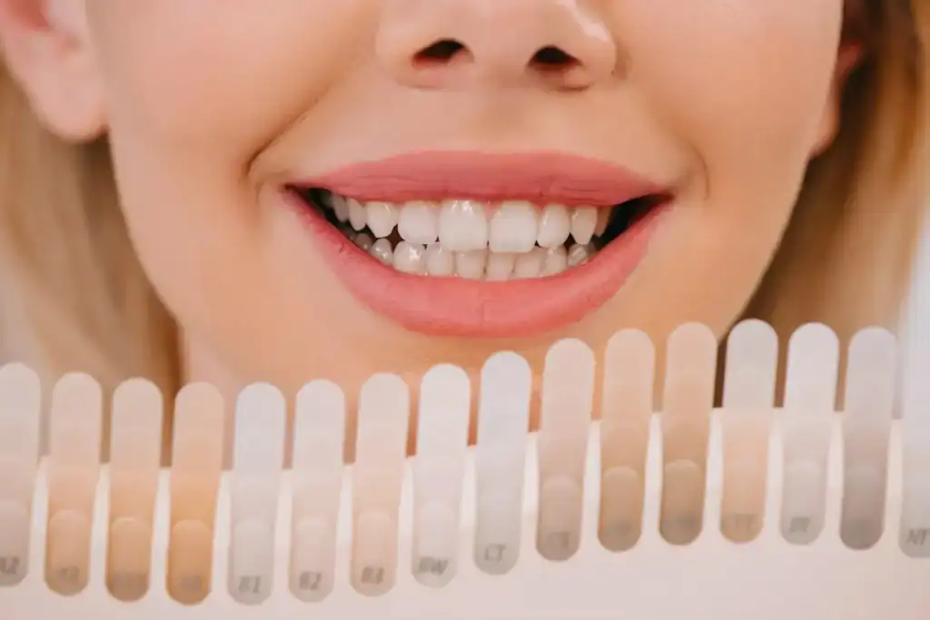 How Can I Maintain My Whitening Results Between Sessions Leighton Buzzard